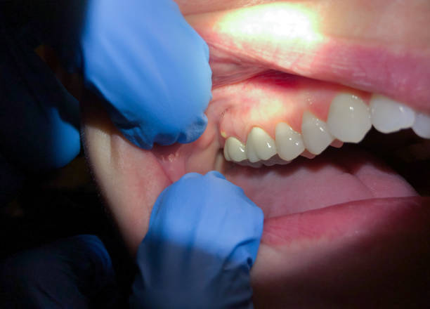 Best Urgent Dental Care for Toothaches in Winston Salem, NC