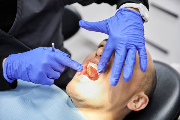 Best Emergency Treatment for Oral Infections in Winston Salem, NC
